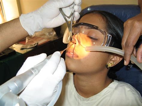 nasal laser surgery